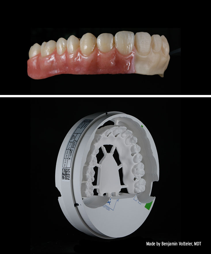 Zolid-Gen-X_Zirconia-Tasting-EN