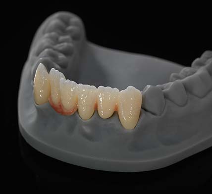 Zolid_Gen_X_10173_428x392px